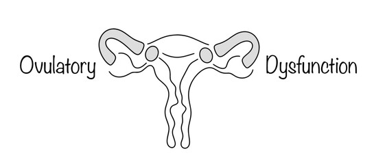 Ovulatory Dysfunction