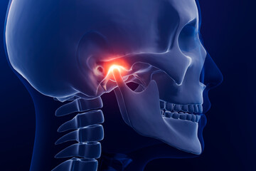 Painful jaw, temporomandibular joint illustration