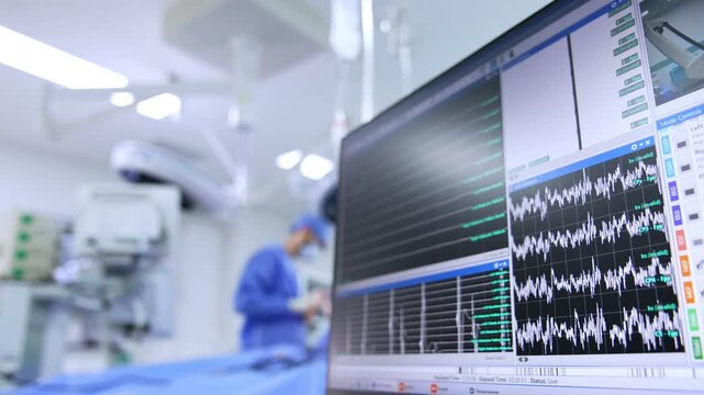 Computer screen with brain waves displayed. Neurosurgical operation performed in modern hospital.