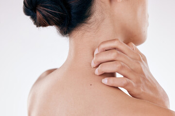 Back, woman and scratch neck in studio with skin irritation, skincare emergency and discomfort of...