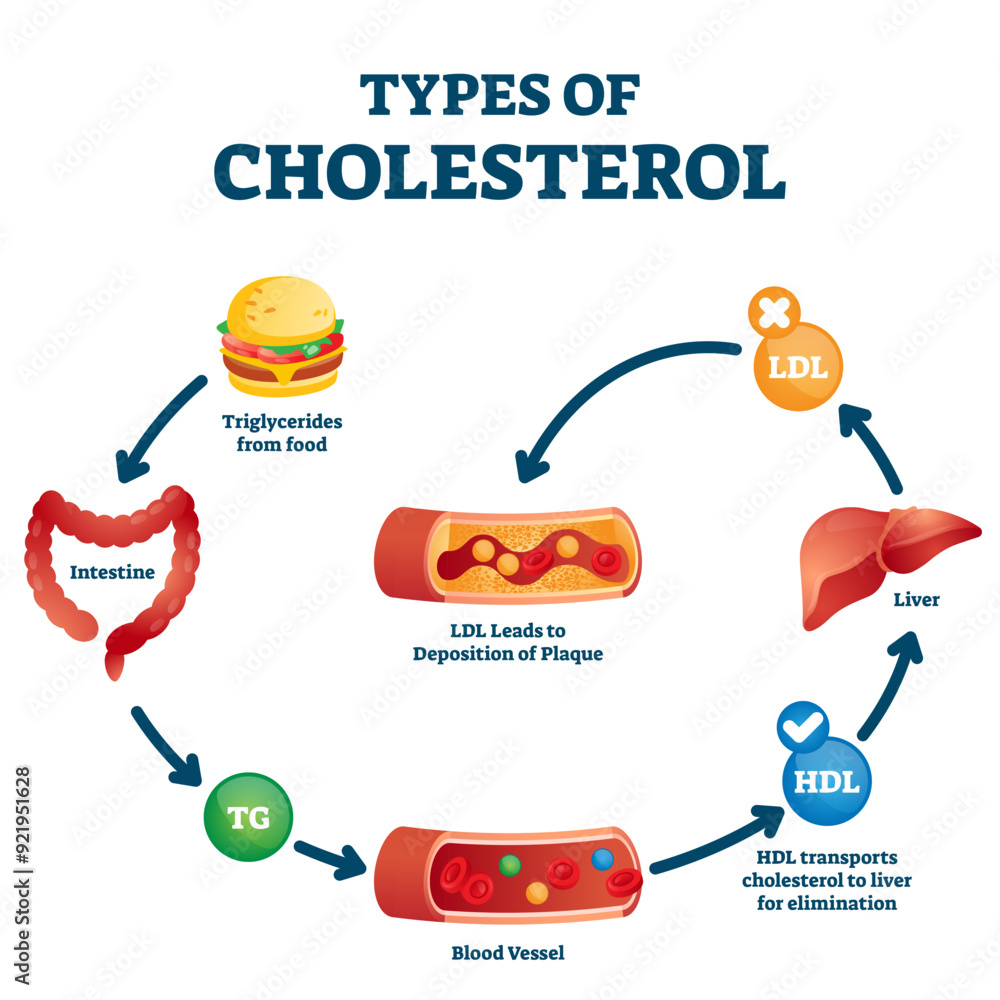 Poster types of cholesterol educational cycle scheme from fatty food to artery, transparent background. lab