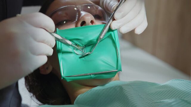 Close-up footage of woman wearing rubber dam in clinic. Dentist with patient at dental office. Tool. Isolation of tooth. Stomatology. Equipment. Healthcare