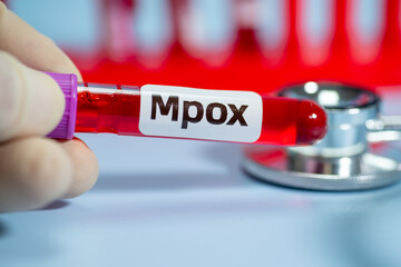 Blood collection tubes monkeypox test positive results,WHO to rename monkeypox as ‘MPOX’	