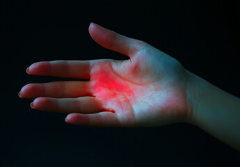 Close-up of a woman's hand with itchy red skin showcasing skin-friendly relief tips