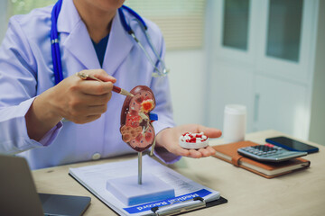 About Kidney Health Close-up of an anatomical model of a human kidney on a doctor's table in the...