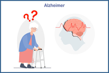 Medical illustration in flat style .Concept of Alzheimer's disease. Elderly woman uses a crutch. There are symptoms of fuzzy memory and forgetfulness, which is a cause of Alzheimer's disease.