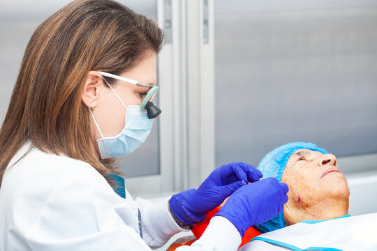 Dermatologist carrying out a skin biopsy on the face of a senior adult patient
