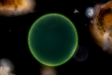 Study of Protozoa and Algae under the microscope for education.