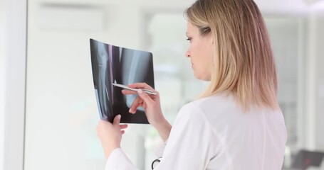 Doctor examines x-ray of hand in hospital room