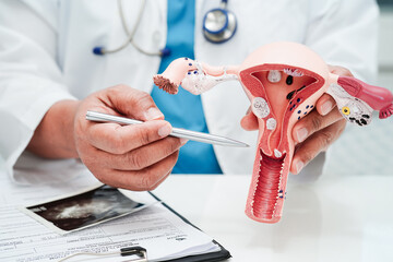 Uterus, doctor holding human anatomy model for study diagnosis and treatment in hospital.