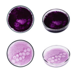 Set of Petri dishes with liquid samples on white background, top and side views