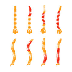 Comparing different human spine shapes with correct and incorrect posture, highlighting back pain areas