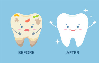 Cartoon tooth before and after cleaning or whitening or dental procedures. Dental comparison concept. Dirty and clean teeth.