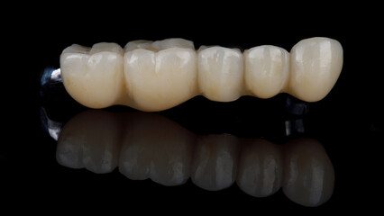 Beautiful dental bridge from zircon, on black glass with reflection