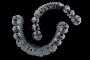 Property Dental Prostheses for Prosthetics Stage, Top view on black background