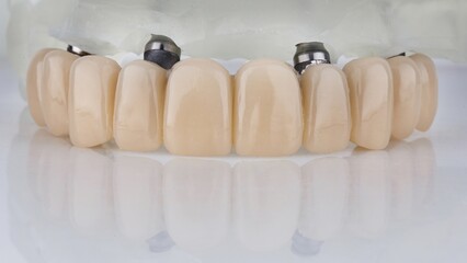 dental prosthesis of the upper jaw in natural color on a metal beam on a white background with reflection © Dental Pro Content