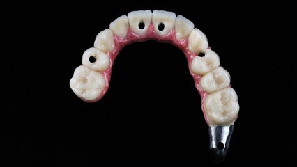 Fototapeta premium ceramic dental prosthesis on a titanium bar top view with the morphology of the teeth on a black background