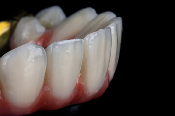 macro dental photo of the prosthesis and relief of the central teeth on a black background