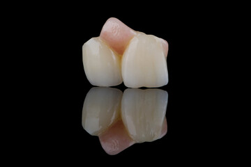 Two dental crowns wit artificial gum made of zirconium for fixation to frontal teeth of upper jaw. © gorynvd