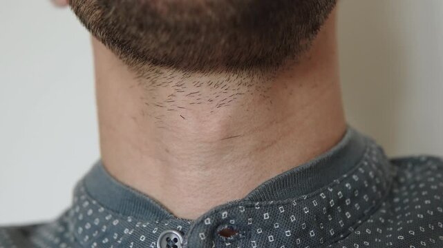 Adam apple and throat of caucasian man during swallowing process close up. Muscle movements on bristly skin during swallowing.