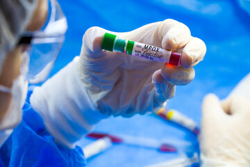 Mpox blood test empty tubes samples