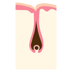 human new hair root illustration 