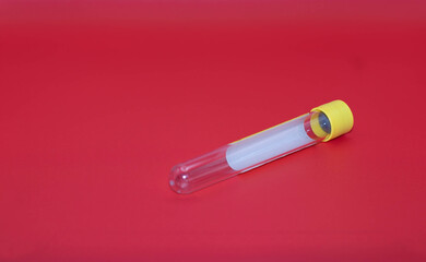 lab technician holding blood tube sample for study / hands of a lab technician with a tube of blood sample and a rack with other samples