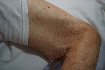 Elderly hands and skin.