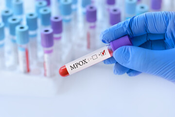 Doctor holding a test blood sample tube with Monkeypox virus (MPXV) .The virus is transmitted from...