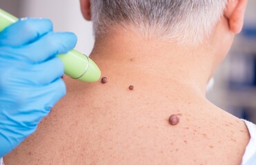 Old man visiting young male doctor dermatologist