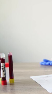 a medical scientist places monkeypox blood test tubes on a table in a clinic and notes the positive and negative results of infected people. high resolution vertical video. For graphic video news.