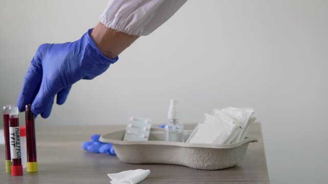 video of doctor wearing medical gloves holding blood tube with monkeypox virus positive blood sample. Renamed by WHO as MPOX. Blood collection tubes on hospital clinic table and tablets.
