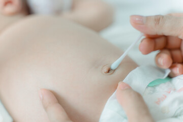 Cleaning the navel of a newborn baby