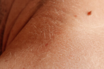 Fototapeta premium Detailed shot of a neck showing a mole, highlighting the natural skin surface and imperfections.