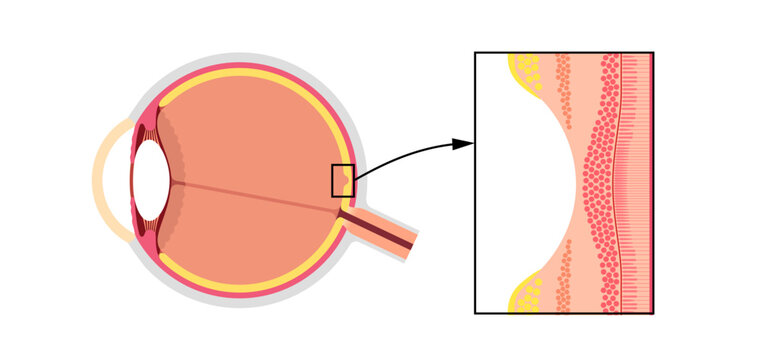 Macula fovea and foveola