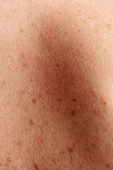 Fototapeta premium Detailed macro shot of skin surface, highlighting its natural imperfections and texture.