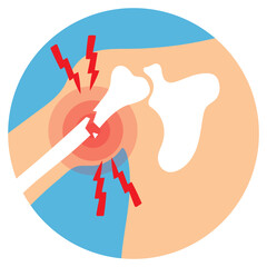 Shoulder Bone Fracture Illustration