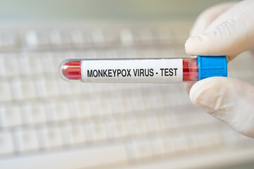 Fototapeta premium Monkeypox Virus (Maymun Çiçeği) Test Kit in the Lab Photo, Uskudar Istanbul, Turkiye (Turkey)