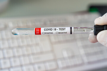 Fototapeta premium Corona Virus Covid 19 Test Kit in the Lab Photo, Uskudar Istanbul, Turkiye (Turkey)