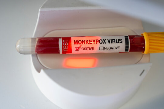 Monkeypox Virus (Maymun &Ccedil;i&ccedil;eği) Test Kit in the Lab Photo, Uskudar Istanbul, Turkiye (Turkey)
