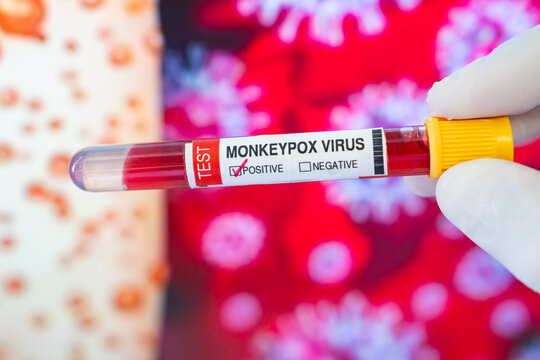Monkeypox Virus (Maymun &Ccedil;i&ccedil;eği) Test Kit in the Lab Photo, Uskudar Istanbul, Turkiye (Turkey)