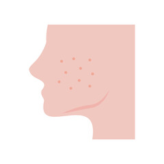 Human face with pimple facial problem icon. Cheek with acne. Healthcare, hygiene, skincare, allergy, treatment, inflammation concepts. Flat vector character design isolated illustration.