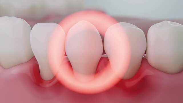 gingivitis warning sign, gums disease symptoms concept.