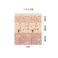 図版_肌図版_007_くすんだ肌