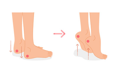 足のむくみ：むくみ解消運動イメージイラスト（ふくらはぎのストレッチ） © mw