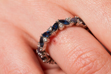 Macro shot of a jewel ring on a female hand.
