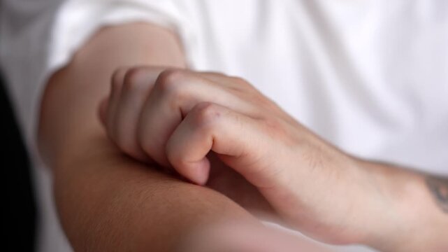Itchy skin.
A man scratches his hand.
Skin problems