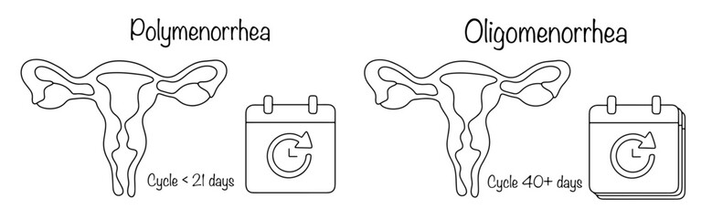 Polymenorrhea. Oligomenorrhea