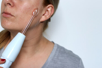 Close up of woman using a high frequency darsonval device on acne skin