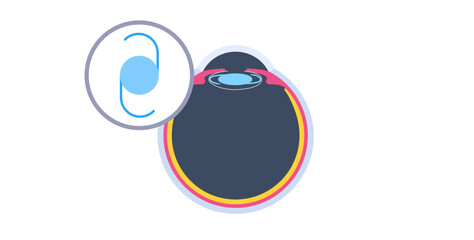 Intraocular lens poster